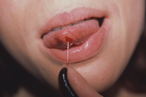 leech, tongue